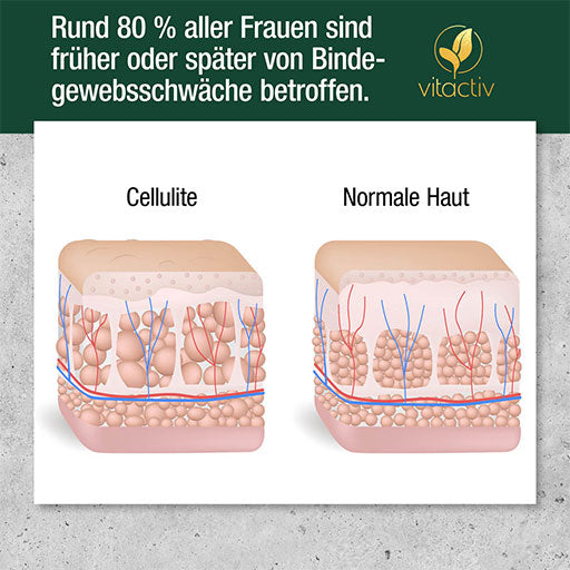 CELLULITE COMPLEX capsules - UKDorf