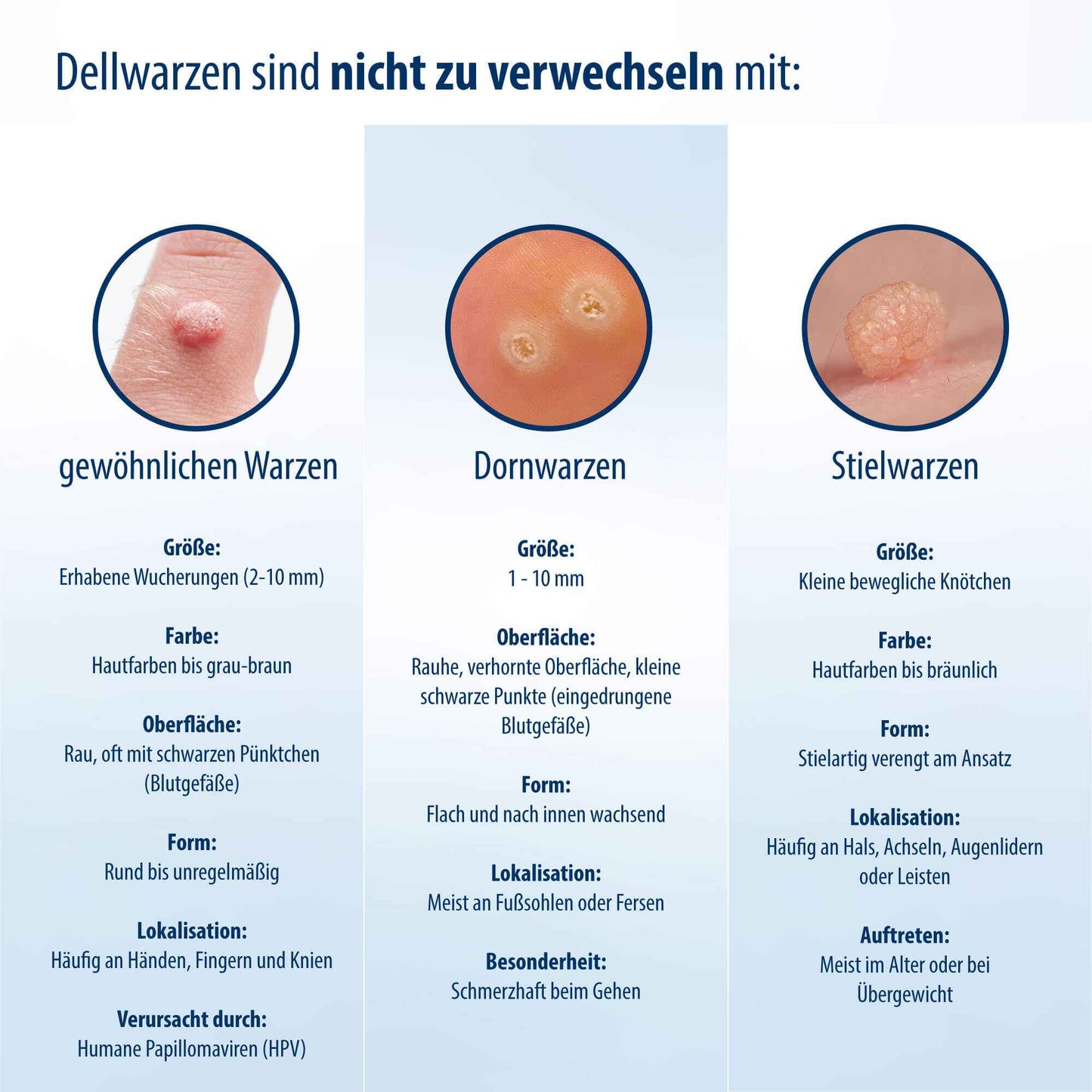 EVOLSIN Molluscum Contagiosum Solution