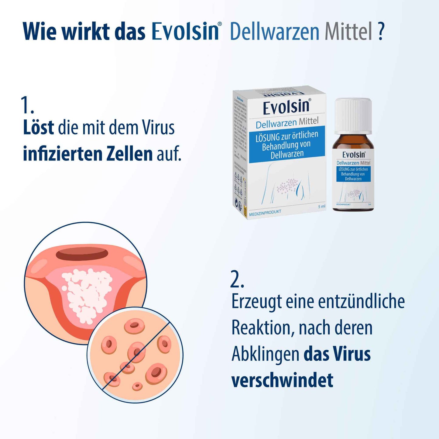 EVOLSIN Molluscum Contagiosum Solution