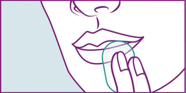 Herpes treatment COMPEED herpes sore patch HRA