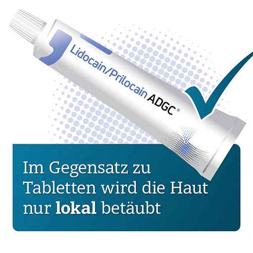 LIDOCAIN PRILOCAIN ADGC cream