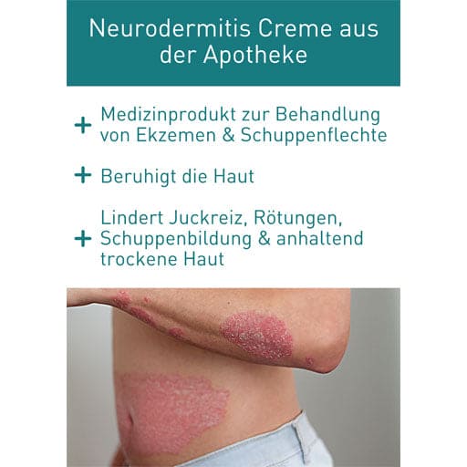N1 Psoriasis Intensive Cream - UKDorf