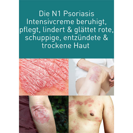 N1 Psoriasis Intensive Cream - UKDorf