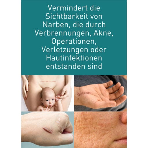 N1 Scar Gel - UKDorf