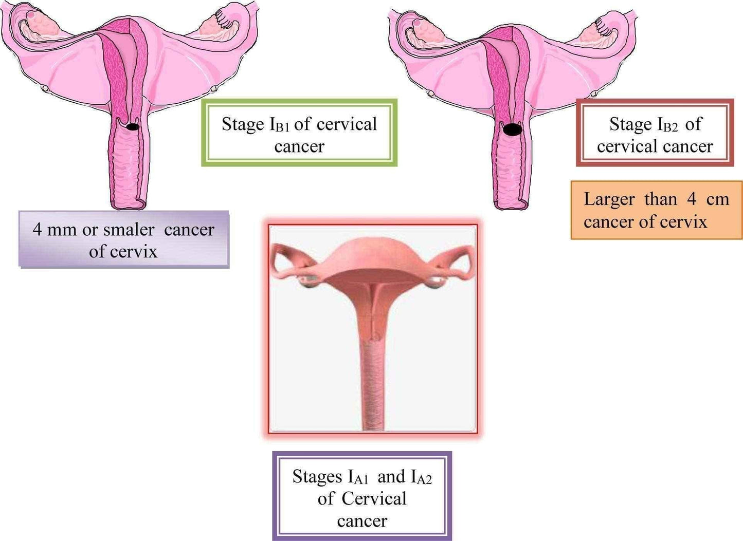 FRD Test for the diagnosis of cervical cancer (applicator + solution) x 1 piece UK
