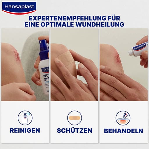 HANSAPLAST Classic plaster 6 cmx5 m - UKDorf