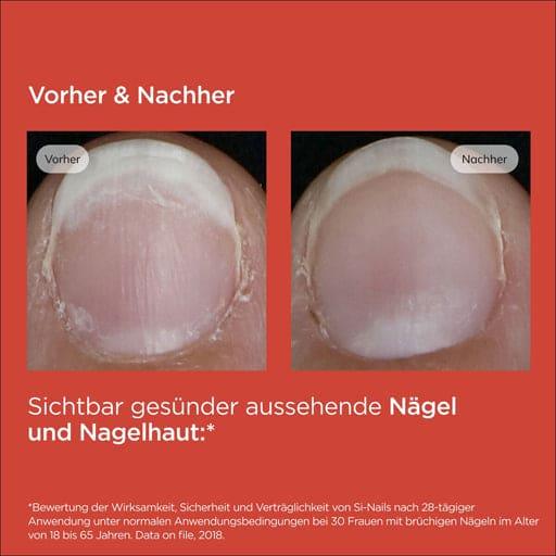 ISDIN Si-Nails nail hardener pen - UKDorf