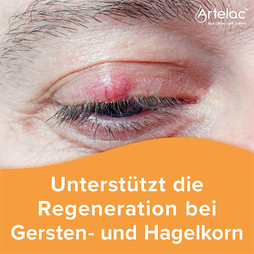 ARTELAC Eyelid Helper Ointment 15 g