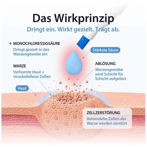 Acetocaustin wart pen 3 ml