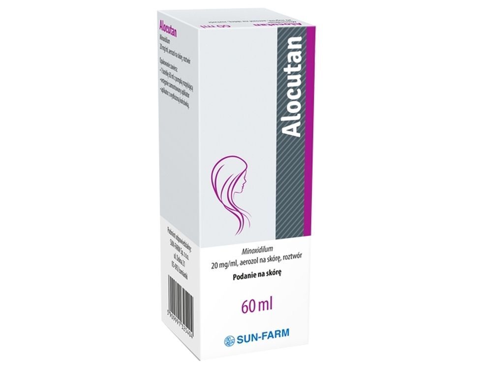 female pattern baldness, early stage female pattern baldness