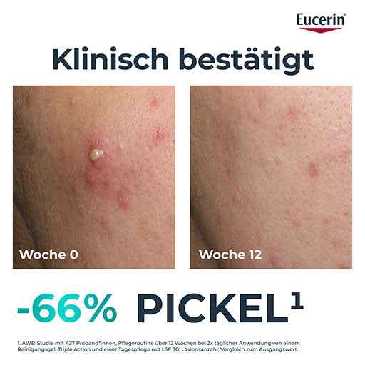 EUCERIN DermoPure Clinical Triple Action Cream