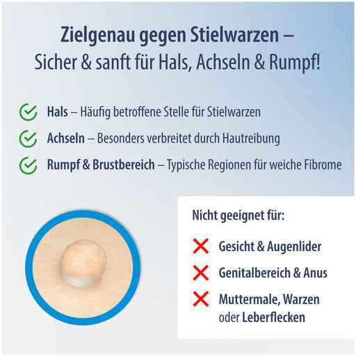 EVOLSIN Skin-Skin wart remover