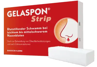 Nosebleeds in children, nosebleed, hemostasis, tooth extraction, GELASPON Strip - UKDorf 
