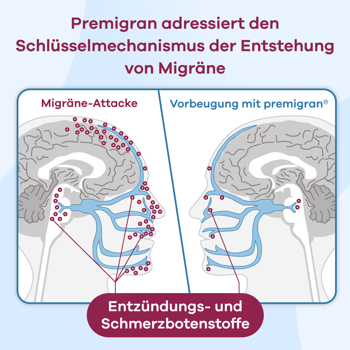 PREMIGRAN Migraine Spray Apriwell Nasal Spray