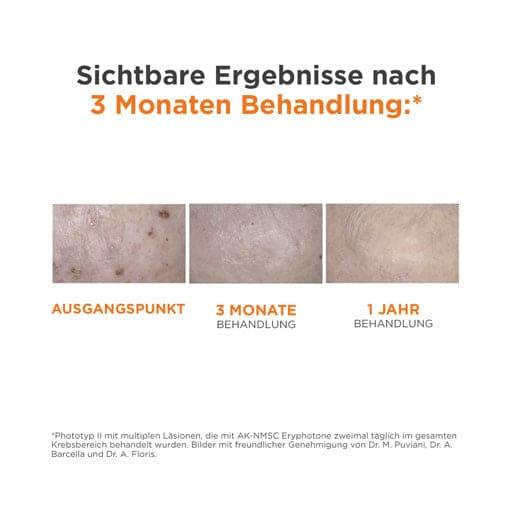 Actinic keratoses, ISDIN Eryfotona AK Fluid - UKDorf 